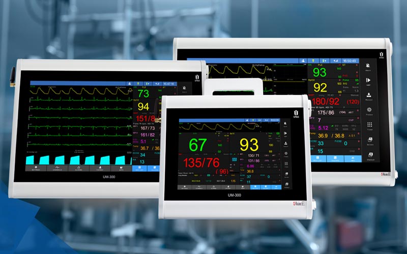 How a Patient Monitor on Rent Ensures Accurate Tracking Without Hassle